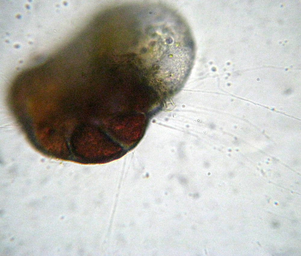 Foraminifera: verosimile Planorbulina variabilis